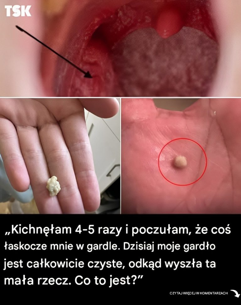 Oto, co musisz wiedzieć o kamieniach migdałkowych