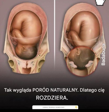 Poród naturalny NIE jest taki, jaki sobie wyobrażałaś